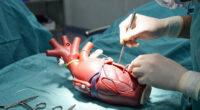 Aortic Dissection