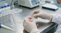 Intestinal Parasite Infection