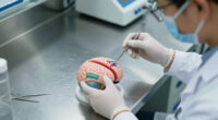 A Controversial Alzheimer's Surgery Is Said To Reverse Symptoms